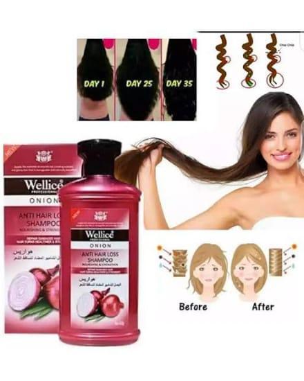 Natural Onion Extract Shampoo with Essential Oils – Anti-Hair Loss & Stimulating Hair Growth